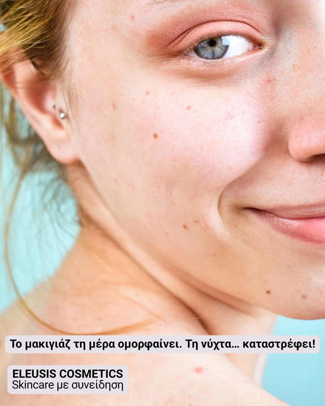 κοπέλα με ερεθισμένα μάτια και θαμπό δέρμα
